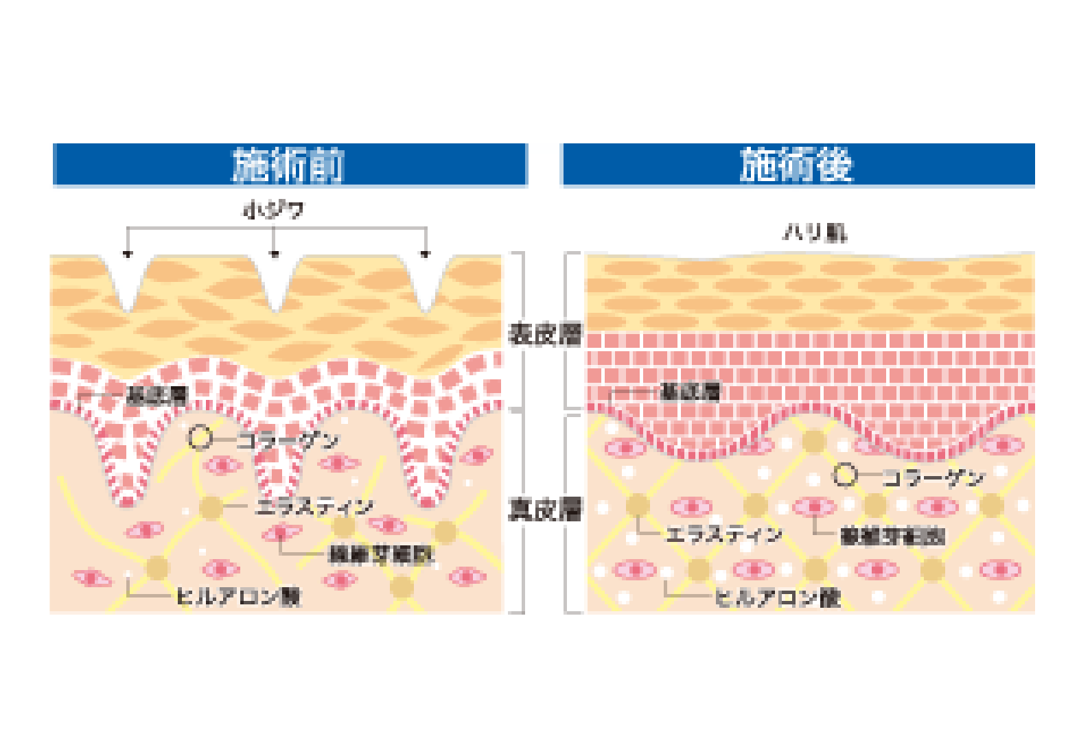 ビフォー・アフター